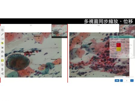 多視窗同步縮放